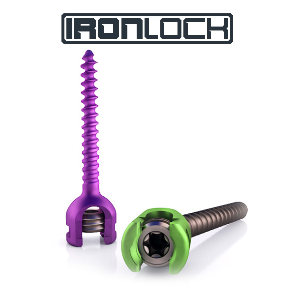 ironlock