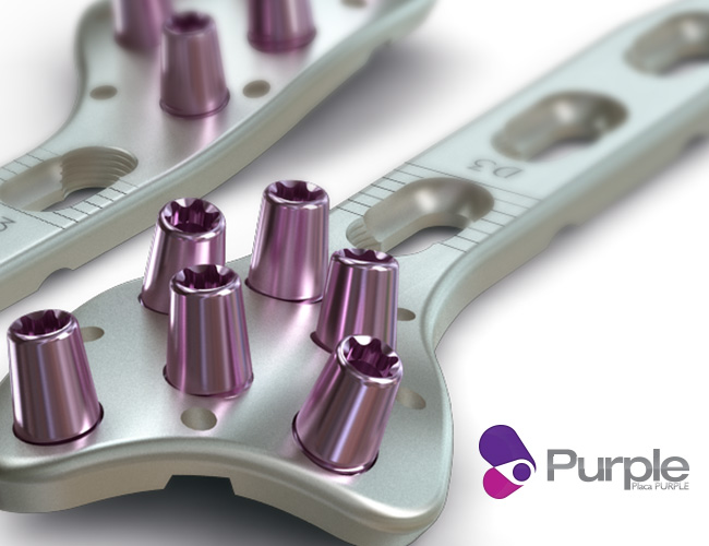 osteoimplants-img2